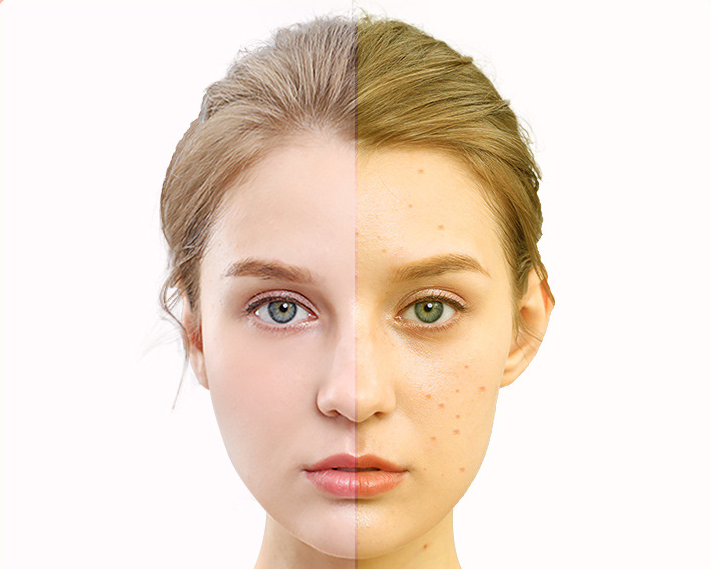 LED Photon Skin Rejuvenation Mask
