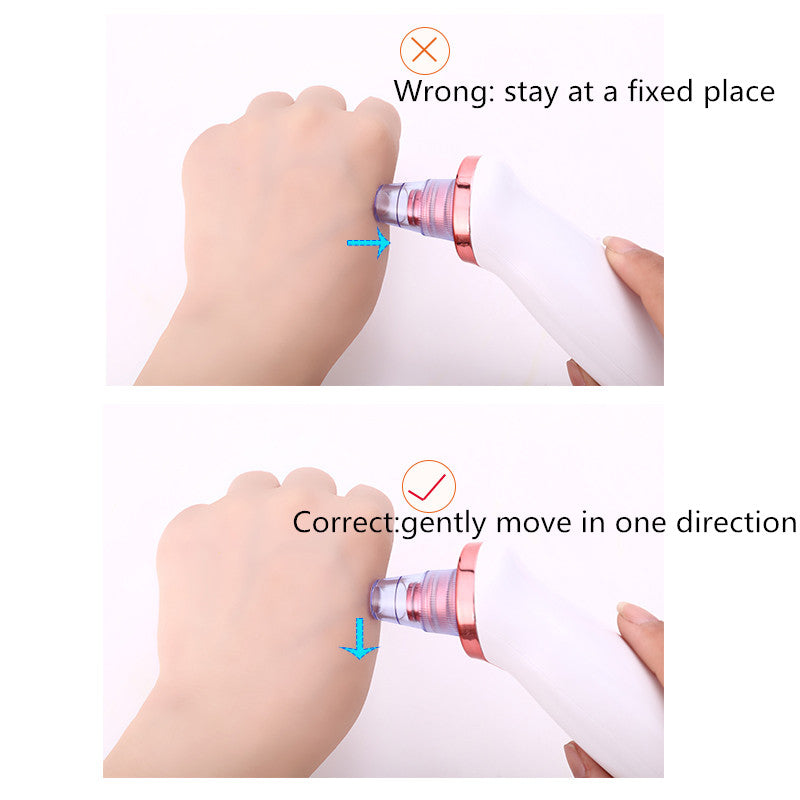 Blackhead Remover Vacuum