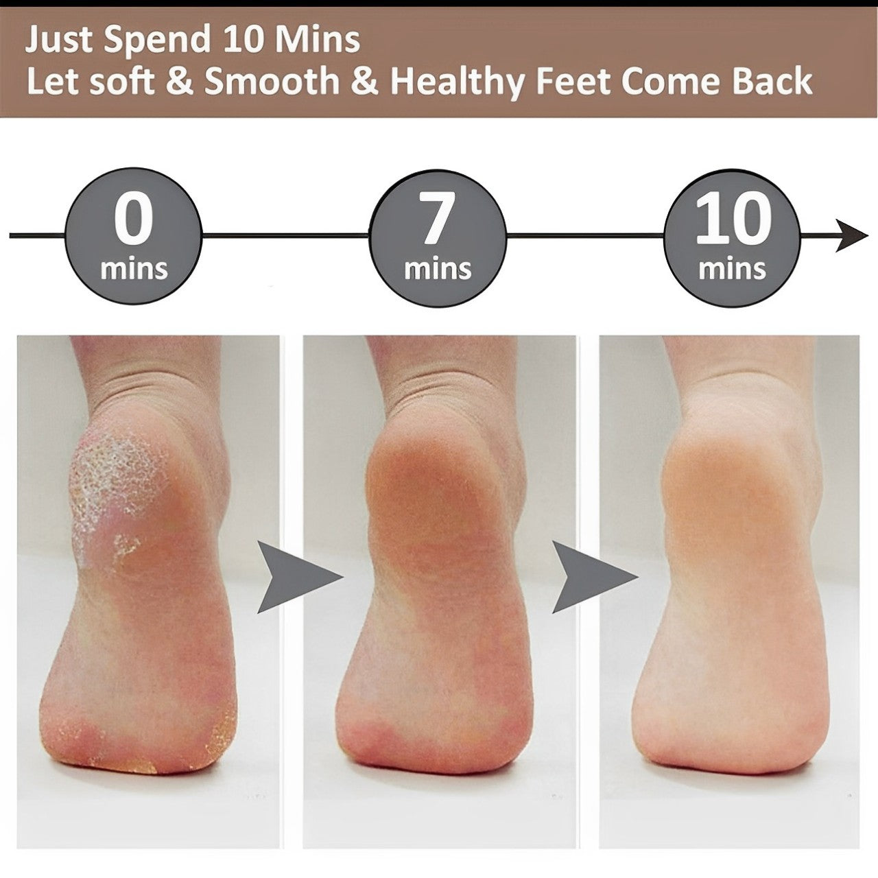 Electric Foot Grinder To Exfoliate Dead Skin