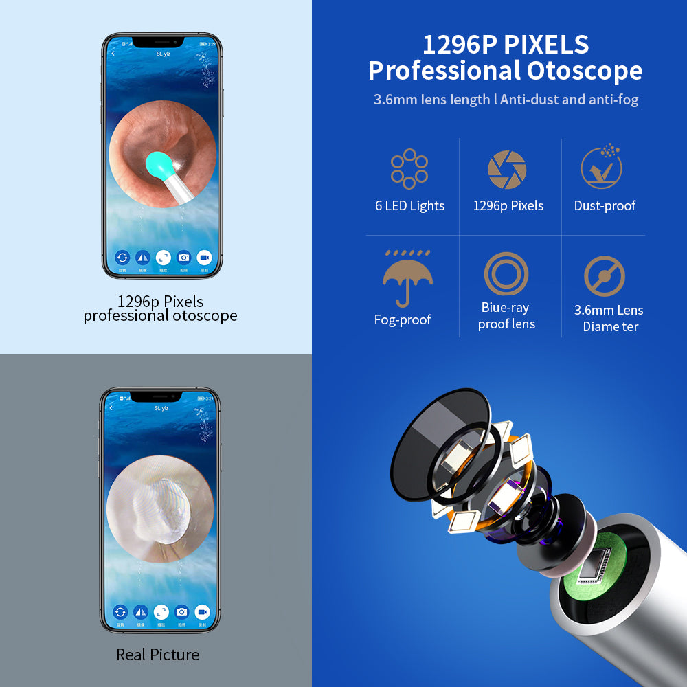 NE3 Wireless Ear Camera & Wax Removal Kit for iPhone